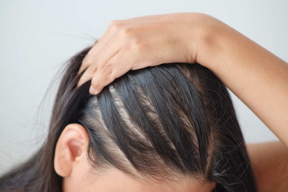 Can Hair Thinning Be A Symptom Of Menopause